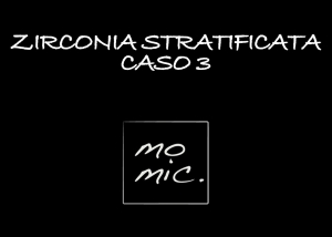 zirconia_caso_3