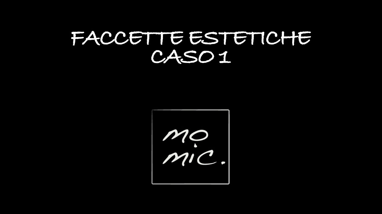 faccette_estetiche_caso_1