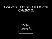 faccette_estetiche_caso_2