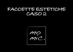 faccette_estetiche_caso_2