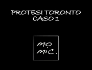 protesi_toronto_caso_1