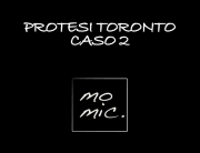 protesi_toronto_caso_2