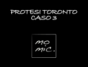 protesi_toronto_caso_3